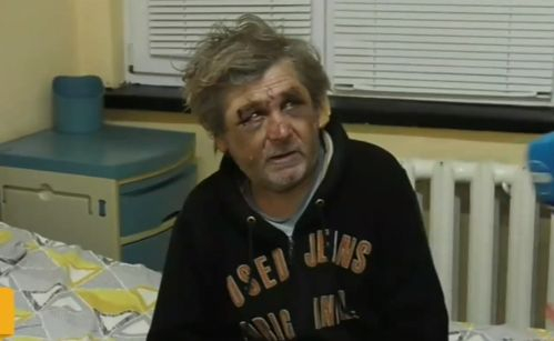 Бой с лопата, рязане на пръсти и юмруци в главата - това трима изверги причиниха на 59-г. мъж в Монтанско ВИДЕО 18+