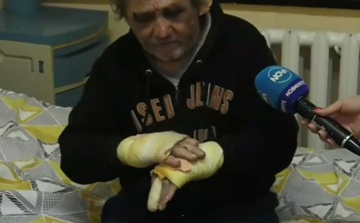 Бой с лопата, рязане на пръсти и юмруци в главата - това трима изверги причиниха на 59-г. мъж в Монтанско ВИДЕО 18+