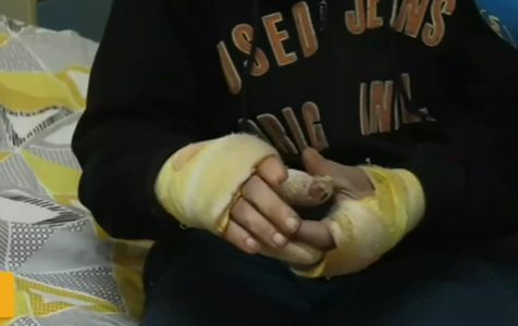 Бой с лопата, рязане на пръсти и юмруци в главата - това трима изверги причиниха на 59-г. мъж в Монтанско ВИДЕО 18+