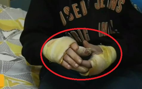 Бой с лопата, рязане на пръсти и юмруци в главата - това трима изверги причиниха на 59-г. мъж в Монтанско ВИДЕО 18+