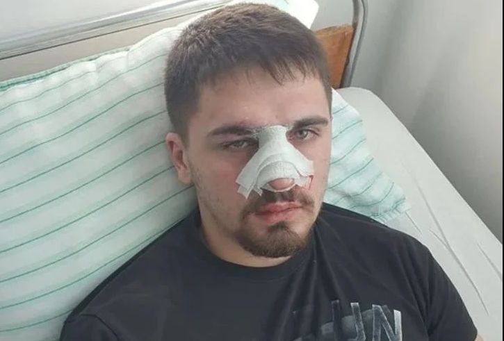 Извънредна вест за ченгетата от Плевен, едва не убили 19-г. Емил!