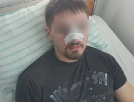 Бащата на пребития младеж в Плевен с последни новини за сина си, разкри за голям проблем 