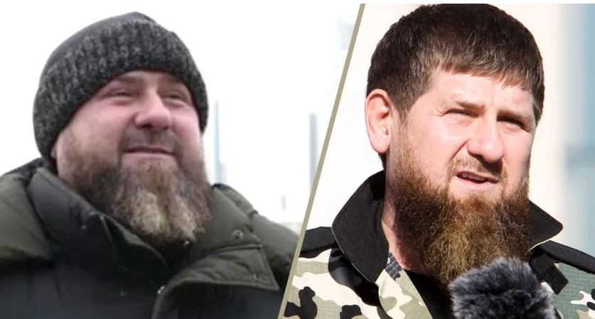 Bild: Рамзан Кадиров има сериозни здравословни проблеми 