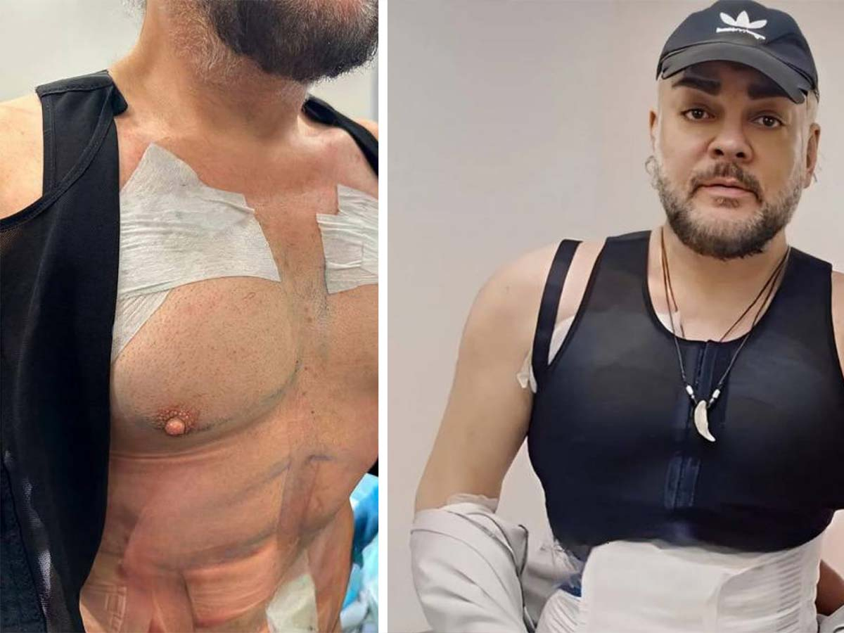 Филип Киркоров шашна с приумица, вече изглежда като... СНИМКИ