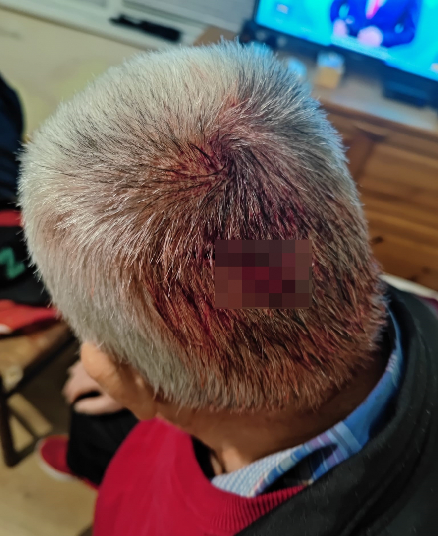 Пълен шок! Мъж отиде със сцепена глава в болница в Стара Загора, пратиха го в гинекологията ВИДЕО 18+