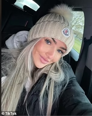 Ужасяващи СНИМКИ на красавица, пекла се на Карибите без предпазващ крем