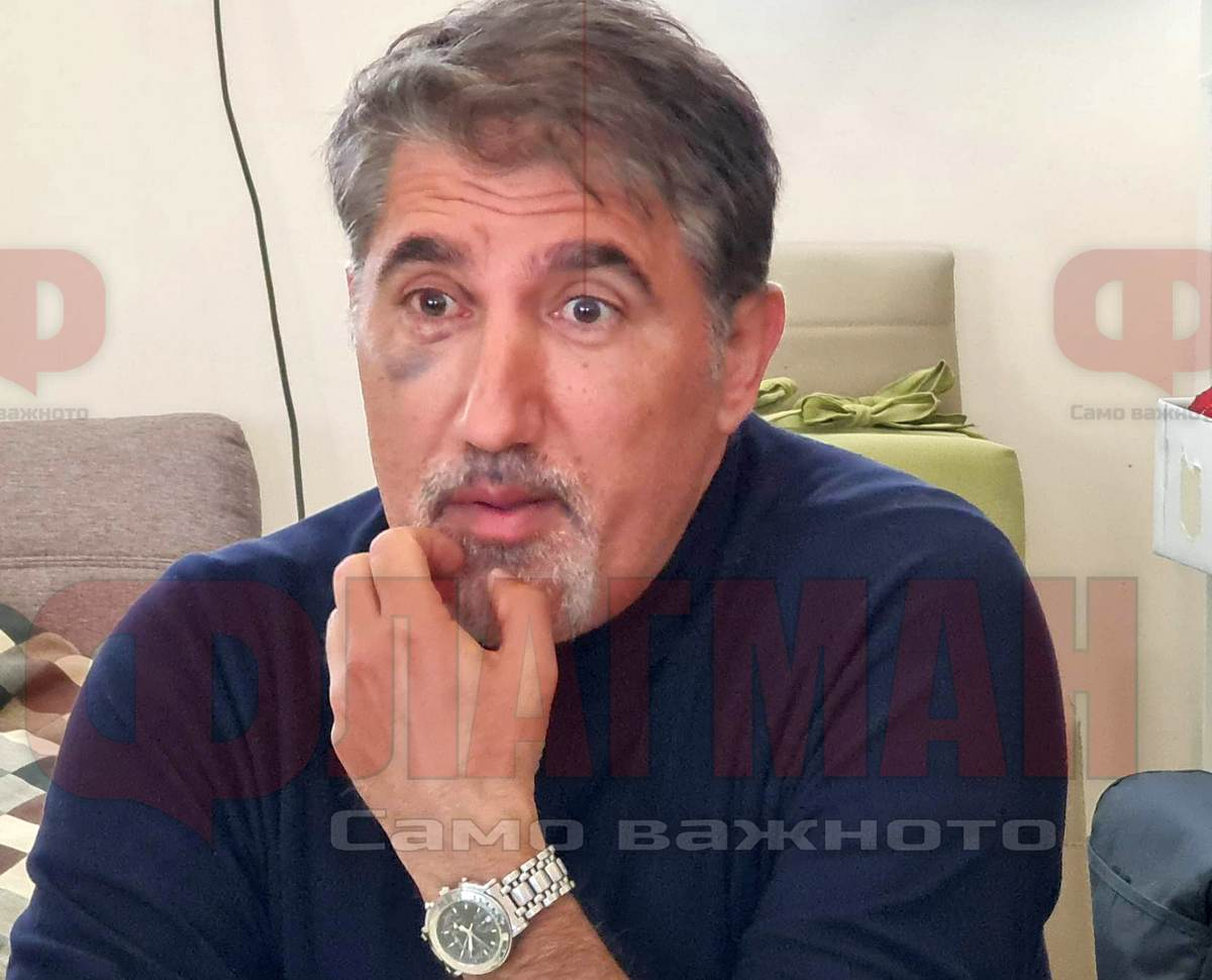 Башар Рахал цъфна в Бургас с насинено око, какво се случва с актьора СНИМКА 