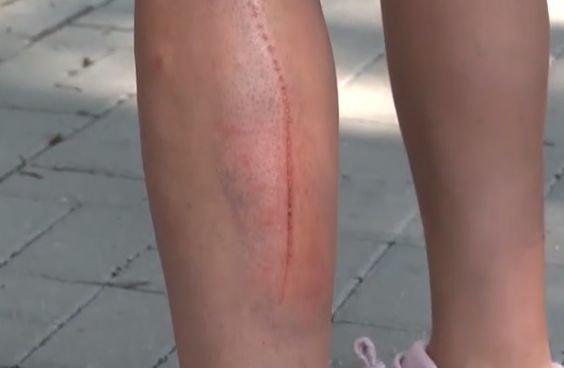 Ужас в София! Ограда за малко да убие дете с Даун ВИДЕО