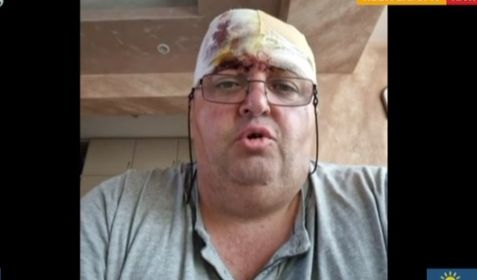 Лекарят, оцелял по чудо в линейката-ковчег, с ужасяващ разказ за касапницата 