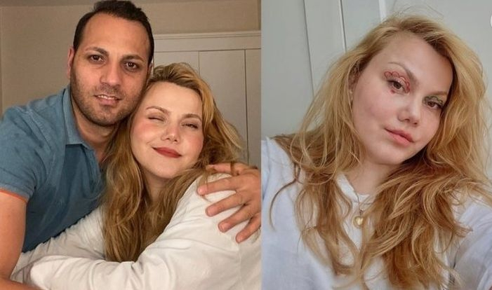 Известна туркиня е наръгана 32 пъти с нож от мъжа си в Истанбул СНИМКИ 18+