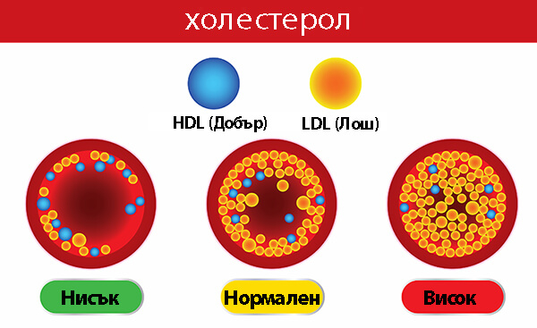 Внимание: Този симптом говори за опасни нива на холестерола