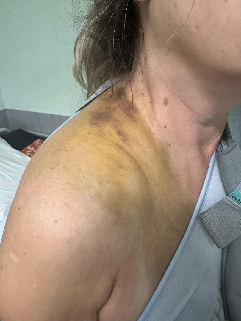 Тъщата на спипания на калъп кмет на Цалапица показа СТРАШНИ СНИМКИ 18+ 