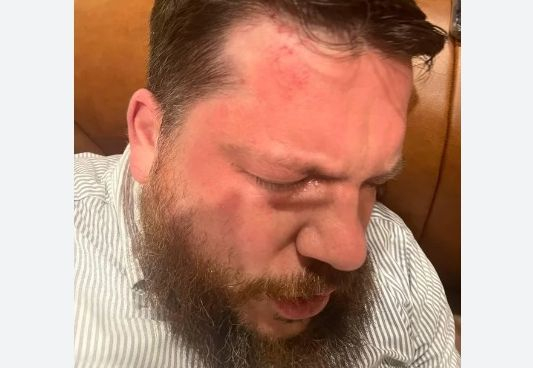 Горещо от спецслужбите на Литва: Стана ясно кои се опитаха да убият съветника на Навални 