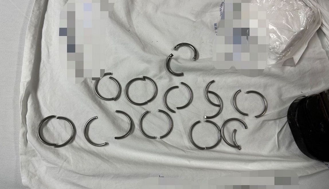 С 11 халки на пениса мъж изпадна в безсъзнание, лекари едва го спасиха СНИМКИ 18+