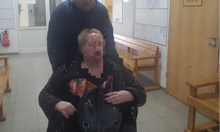 Протакват делото на садистите, обезобразили ясновидката Тони с киселина, причината е...