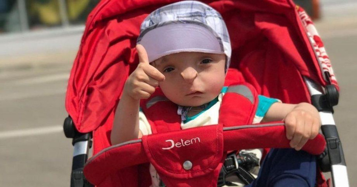 Той се роди без уста, нос и крак, с дупка на лицето, ето какво се случи с него СНИМКИ