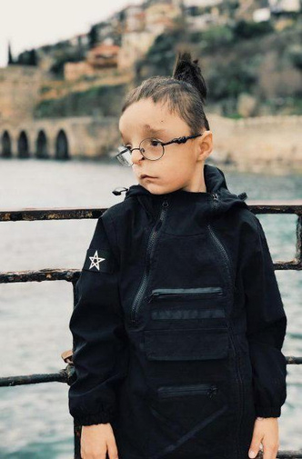 Той се роди без уста, нос и крак, с дупка на лицето, ето какво се случи с него СНИМКИ