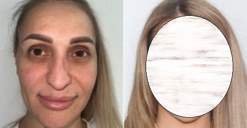 Уау! Катрин мина под ножа и сега трябва да си смени паспорта СНИМКИ