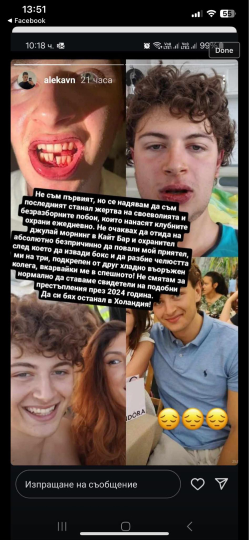 Охранител грабна бокс и преби 19 г. момче на Черноморието, причината е скандална СНИМКИ 18+