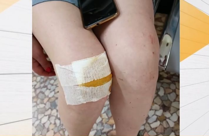 Шофьор блъсна варненка, закара я изпотрошена до болницата и после направи немислимото ВИДЕО