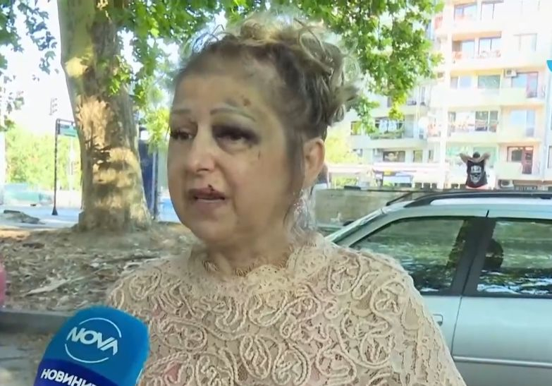 Шофьор блъсна варненка, закара я изпотрошена до болницата и после направи немислимото ВИДЕО