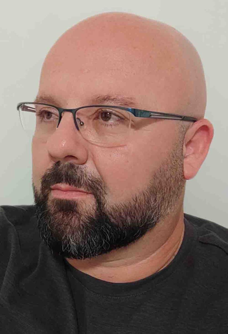 Д-р Милевски изброи симптомите на колоректален рак