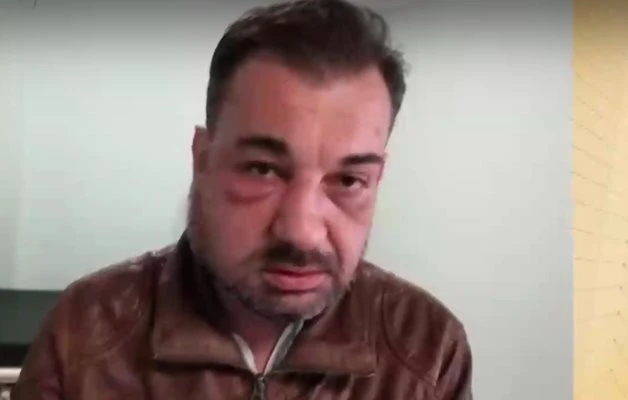 Ужас: Отвлякоха българин, пребиха го и го връзваха със свински опашки, намесени са много пари