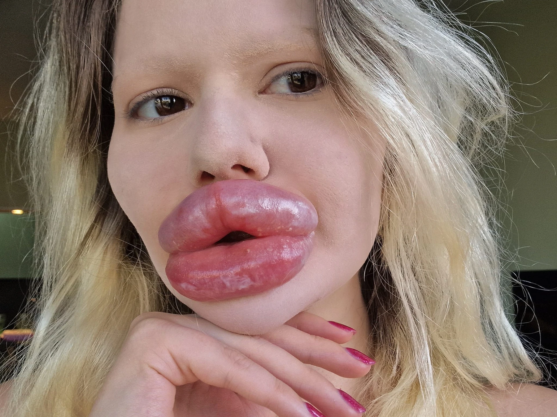 Бургаското Барби Андреа напомпа още джуките си, ето на какво заприлича СНИМКА