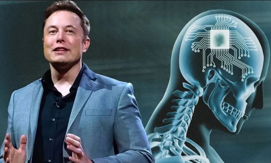 Мъск разказа за уникалните особености на новия имплант Neuralink