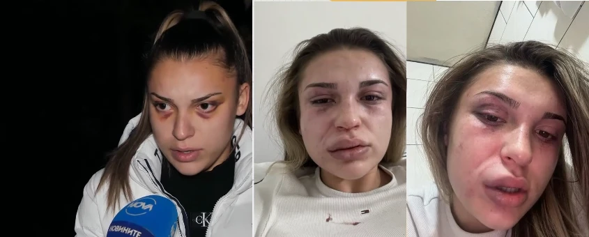 Ивана проговори за 15-минутния ужас в Кресна: Удряше ме в главата, разкъса ми дрехите и накрая ме... ВИДЕО