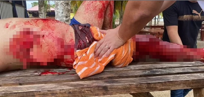 ВИДЕО 18+ запечата как отмъстиха на акула за кърваво нападение над човек