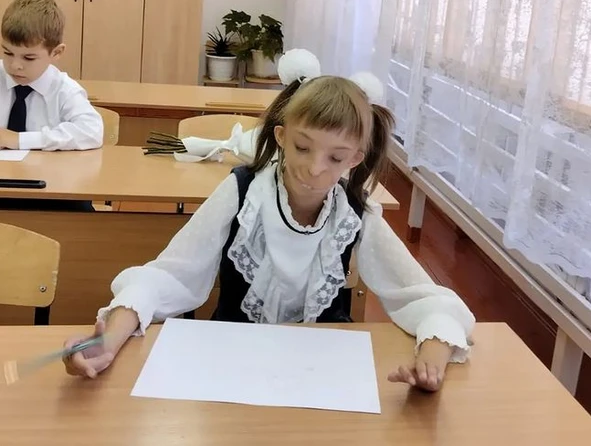Семейството й се отказа, не може да я гледа: Всички се чудят как изглежда „момичето с половин лице“ СНИМКИ 18+