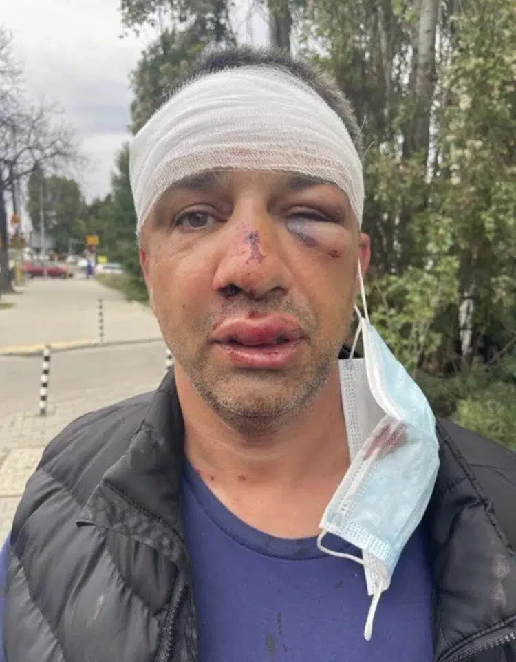 На вниманието на МВР: Небезизвестните Радо Въшката и Бисер Сопола чупят рекорди в кражбите от автомобили в столицата СНИМКИ