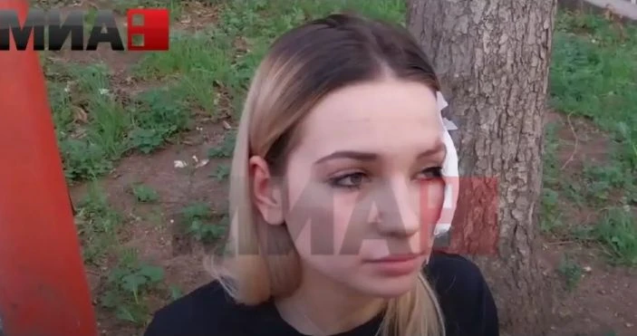 Жертвите на ужаса в Кочани са на възраст между 14 и 24 години, певец от групата - на апаратно дишане