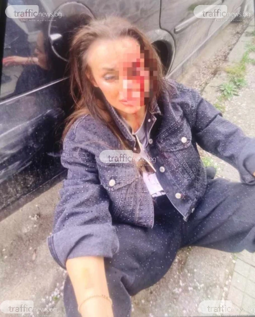 Кървава драма в Пловдив: Спор за имот прерасна в меле, жена е в болница СНИМКИ 18+