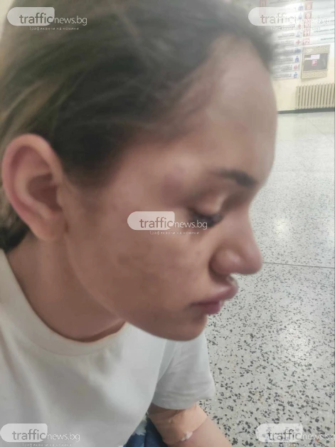 Кървава драма в Пловдив: Спор за имот прерасна в меле, жена е в болница СНИМКИ 18+