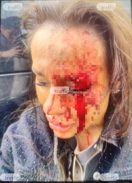 Кървава драма в Пловдив: Спор за имот прерасна в меле, жена е в болница СНИМКИ 18+