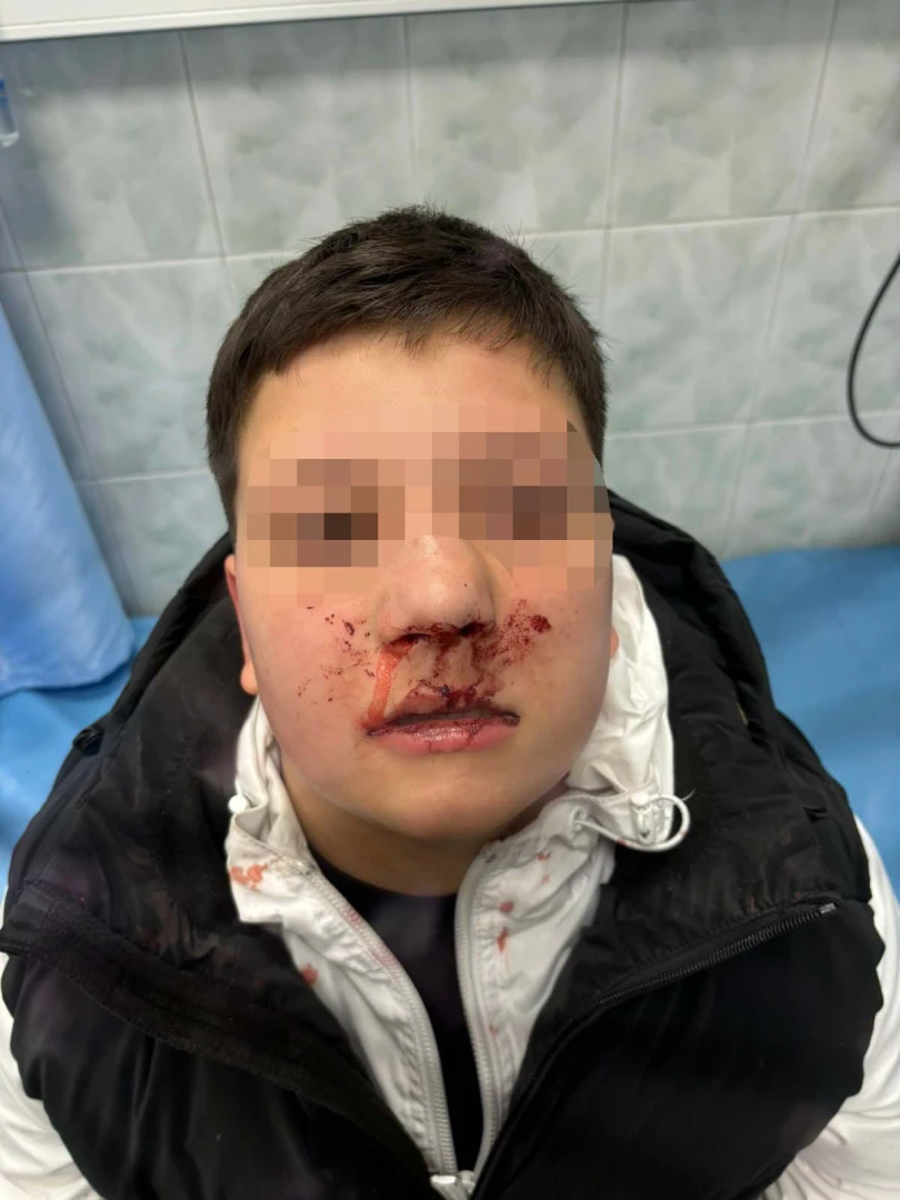 Невиждана жестокост! Клаха с ножове и помляха с чукове 12-годишен в Бургас ВИДЕО 18+