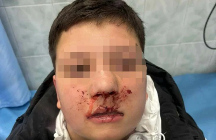 Невиждана жестокост! Клаха с ножове и помляха с чукове 12-годишен в Бургас ВИДЕО 18+
