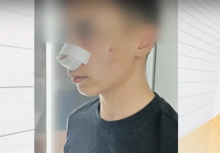 „Помня само един удар“: Смязаха от бой 13-г. ученик в Русе