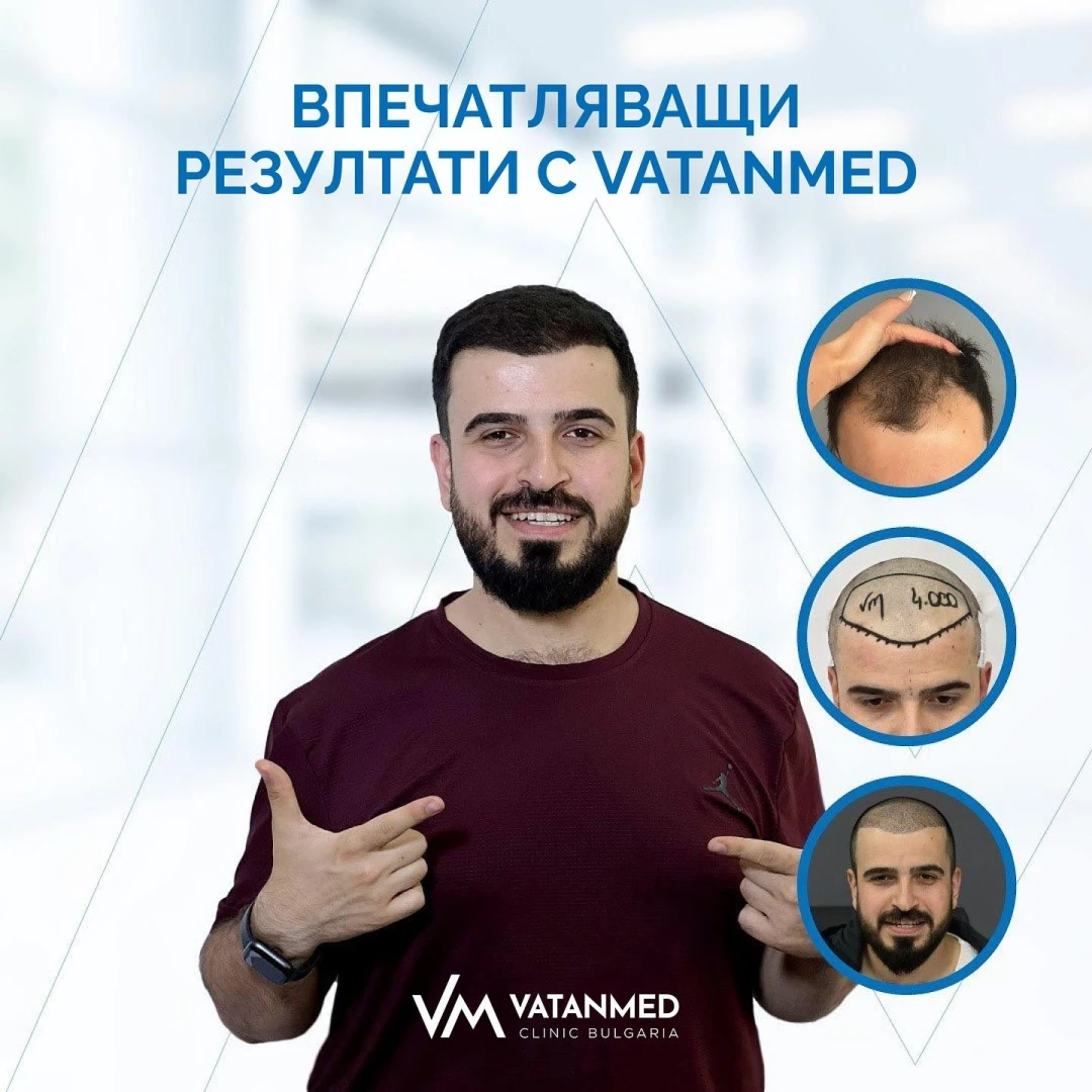 Искате нова коса? VatanMed предлага решение от световен клас 