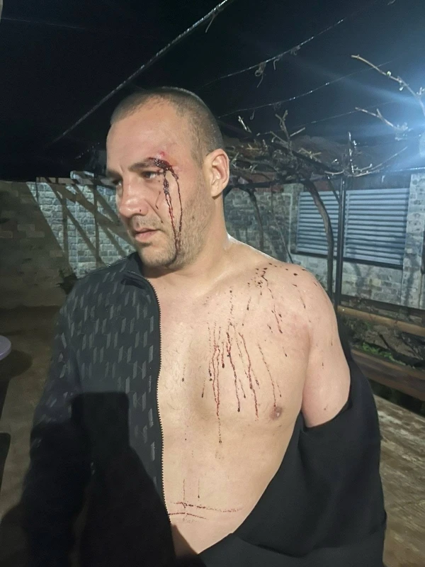 Бабаитите с бухалки пребивали и други хора в Бяла Слатина! Тяхна жертва проговори Снимки 18+