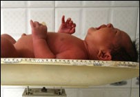 Обезщетение за разделени погрешка в болница близначки